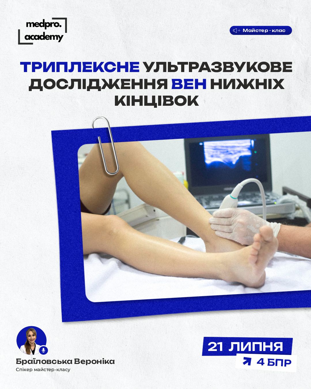 3Триплексне ультразвукове дослідження вен нижніх кінцівок